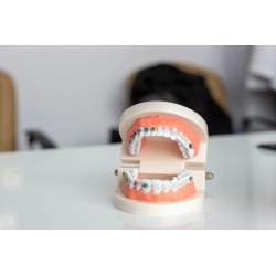 Tratamente de ortodonție